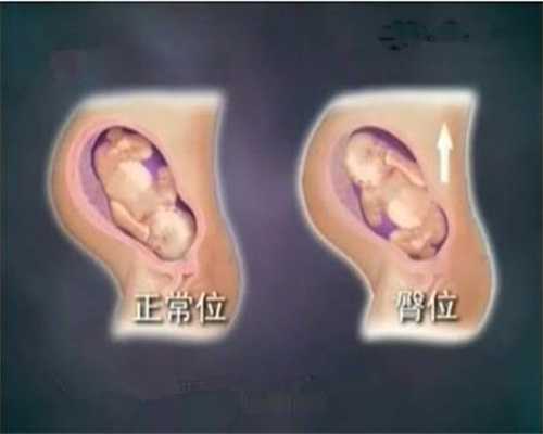 广州世纪助孕包成功_广州助孕服务_代试管代孕选择性别多少钱_哪里代生孩子