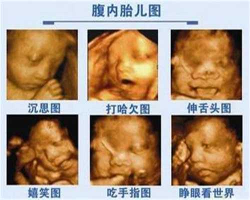 广州世纪代孕怎么联系,怎么判断胎儿进入产道