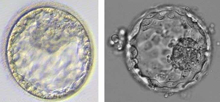 欣欣宝贝助孕[山大一院供卵]+试管婴儿胚胎选哪种好？移植哪种胚胎比较好？
