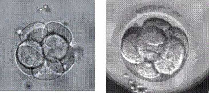 欣欣宝贝助孕[山大一院供卵]+试管婴儿胚胎选哪种好？移植哪种胚胎比较好？